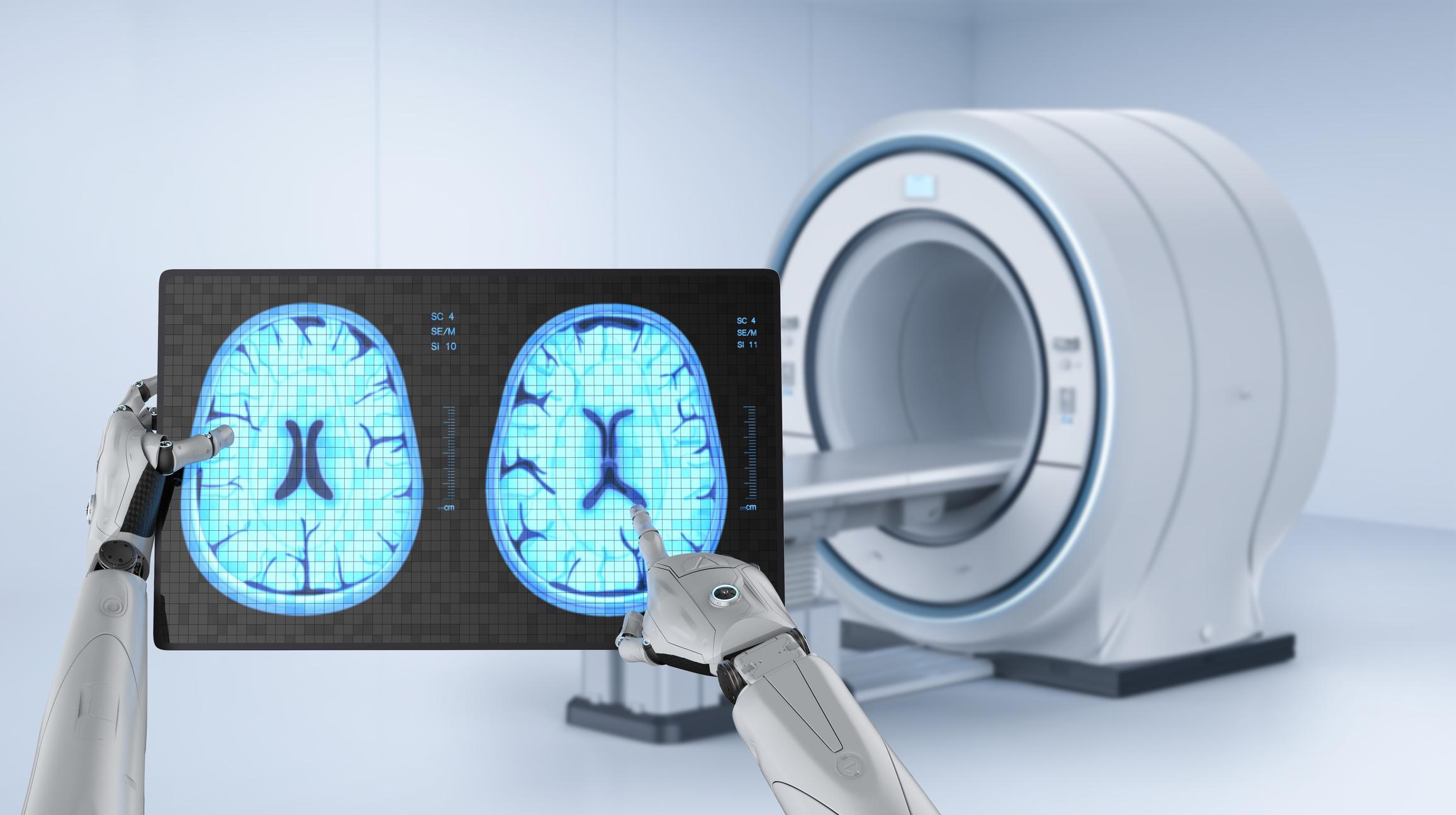 Come l'intelligenza artificiale scopre minuscoli tumori